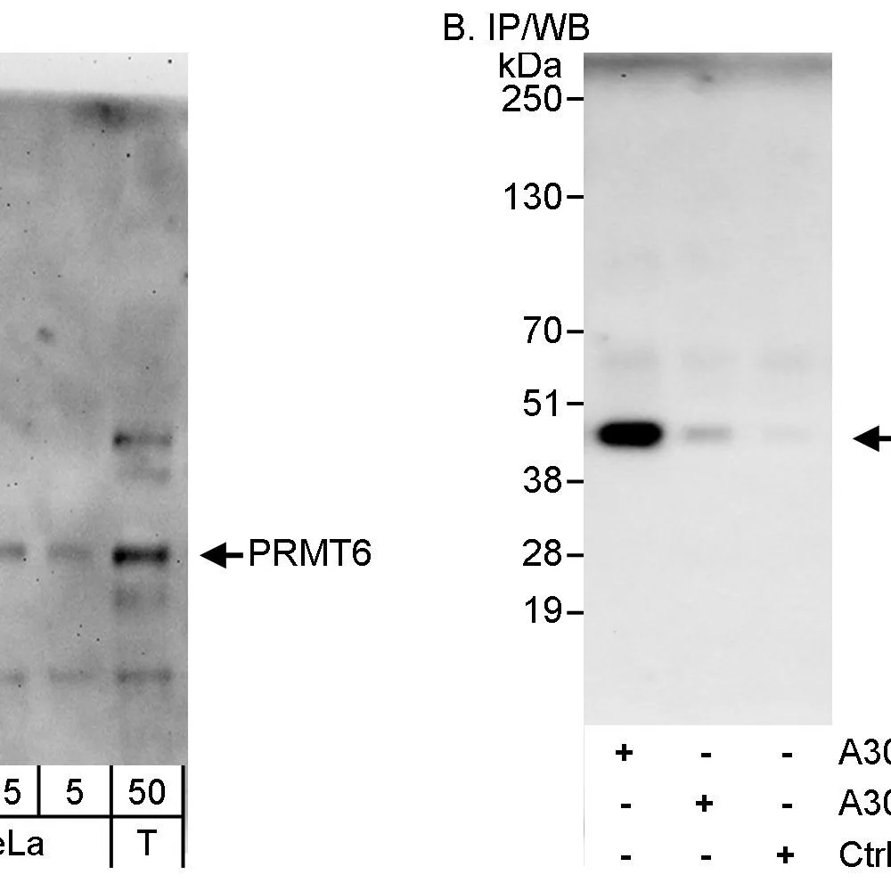 Rabbit anti-PRMT6 Antibody, Affinity Purified