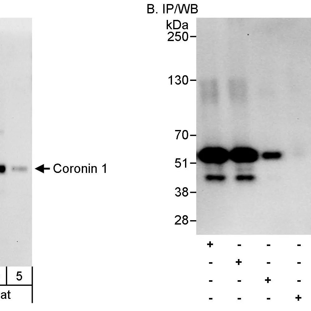 Rabbit anti-Coronin 1 Antibody, Affinity Purified