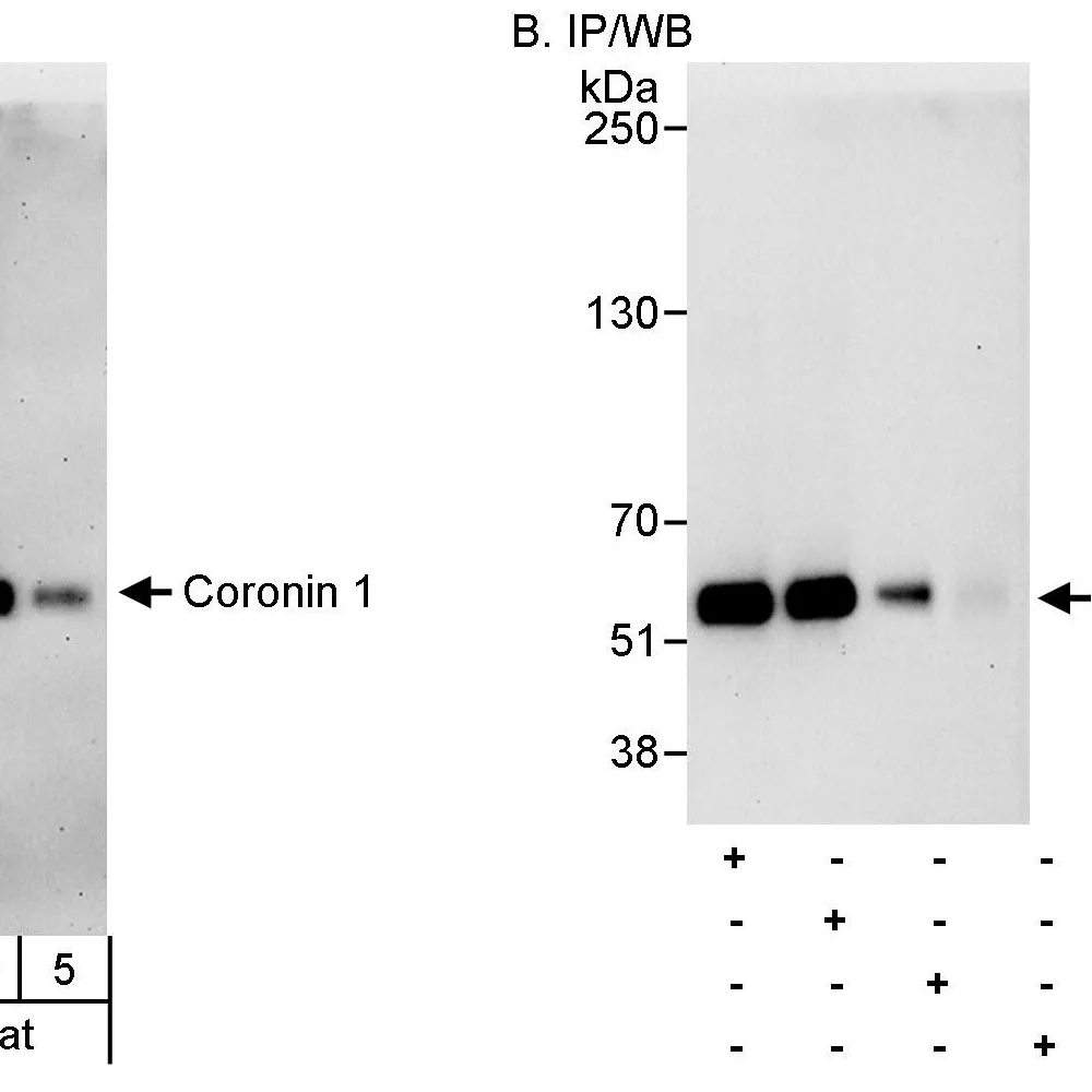 Rabbit anti-Coronin 1 Antibody, Affinity Purified