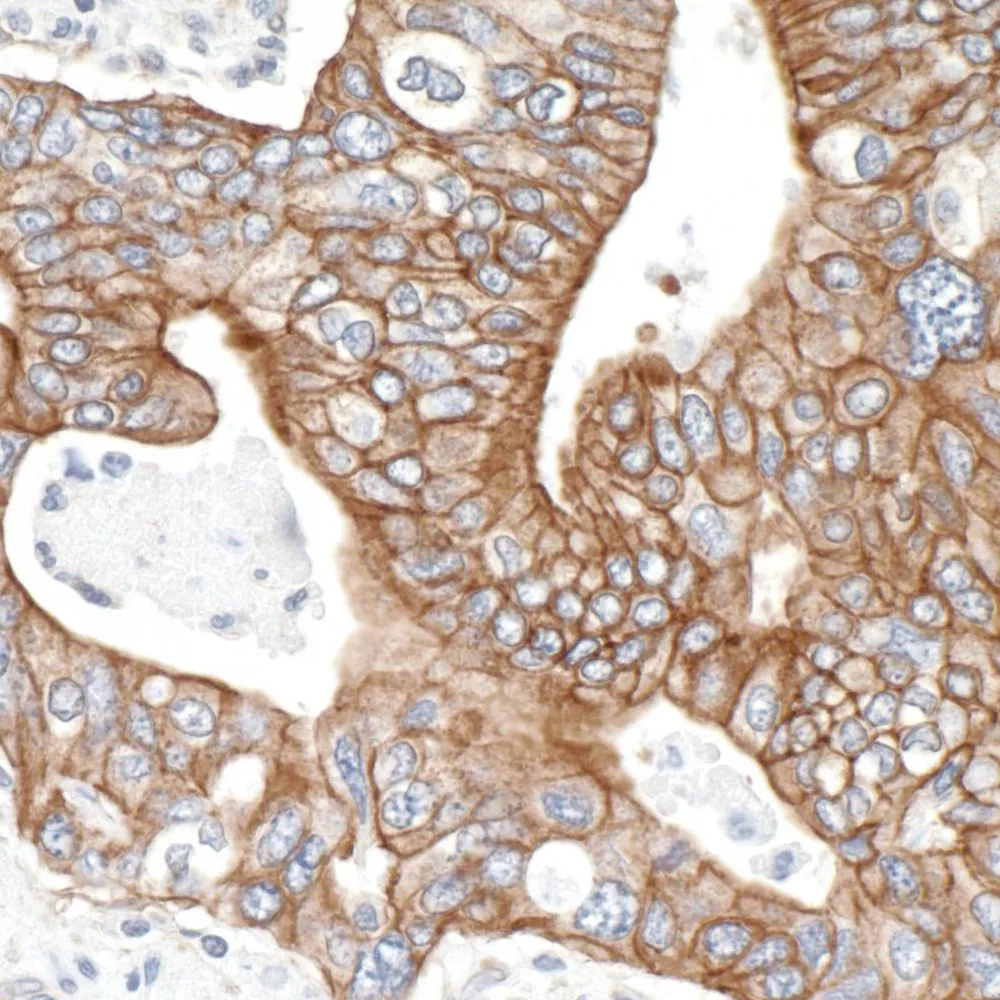 Rabbit anti-SPTBN1 Antibody, Affinity Purified