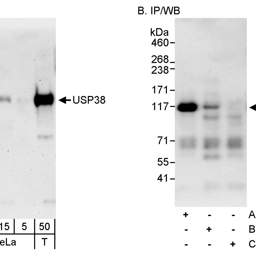 Rabbit anti-USP38 Antibody, Affinity Purified