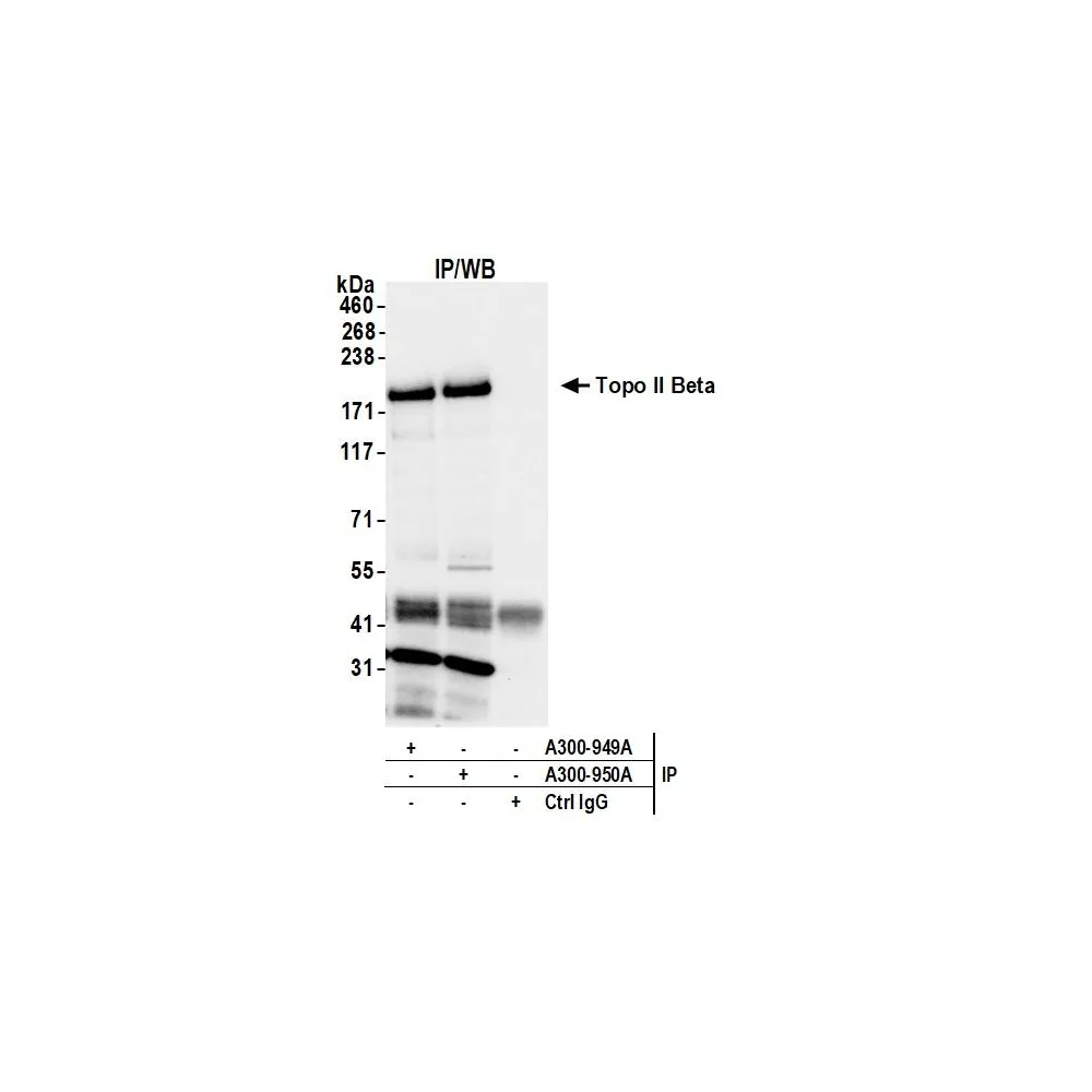 Rabbit anti-Topo II Beta Antibody, Affinity Purified
