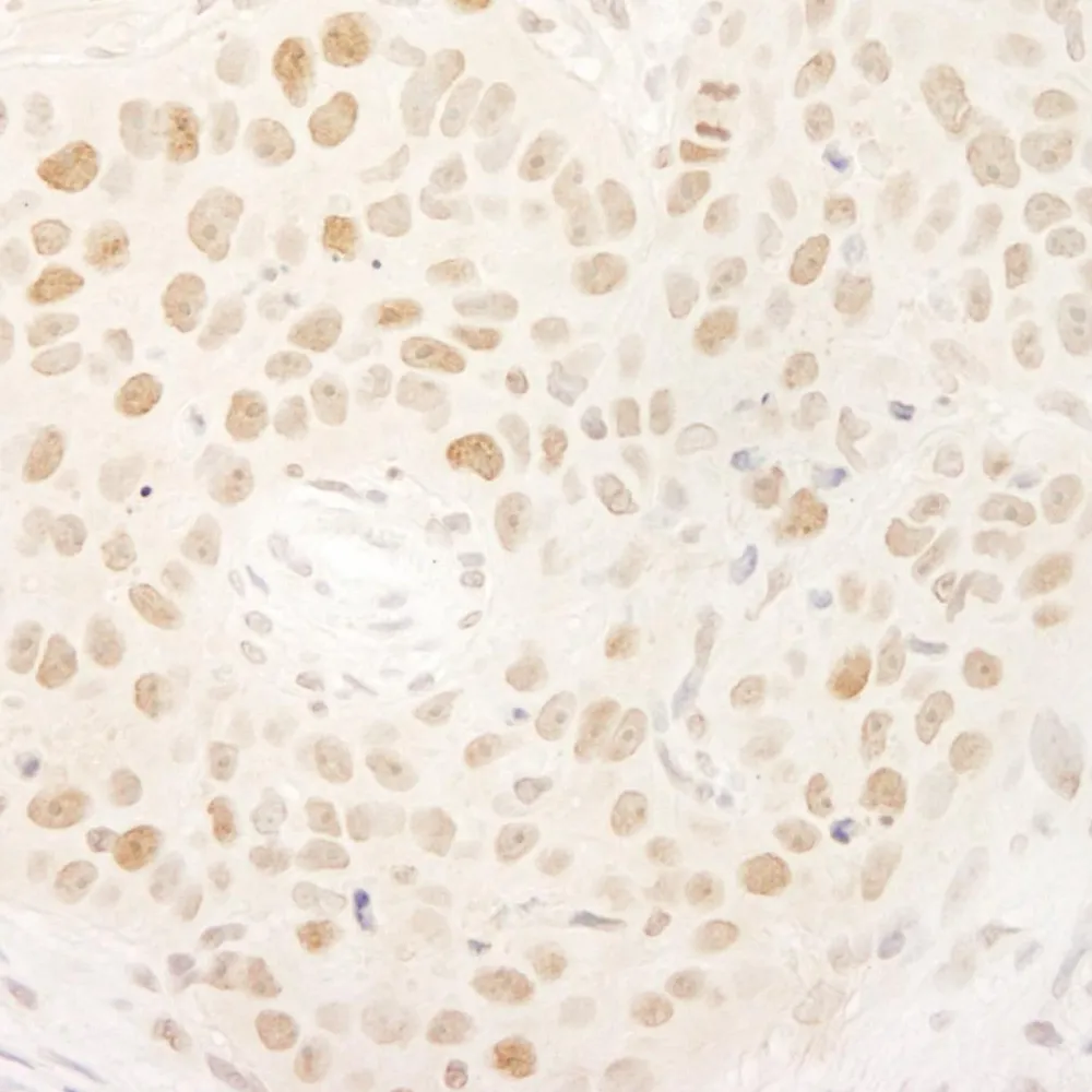 Rabbit anti-KIFC1/MKLP2 Antibody, Affinity Purified