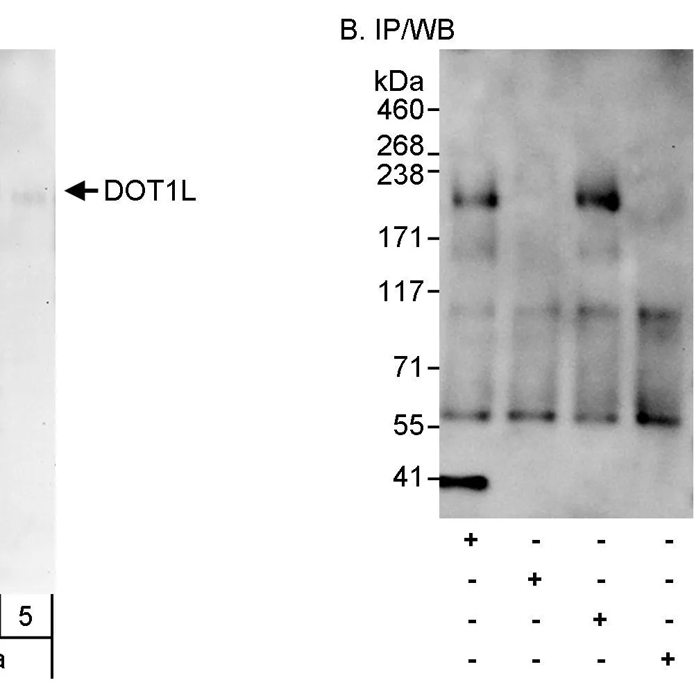 Rabbit anti-DOT1L Antibody, Affinity Purified