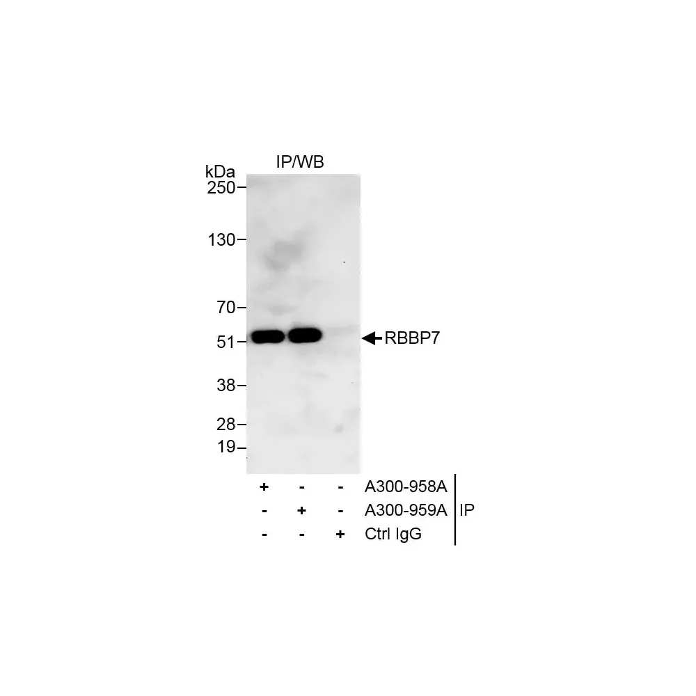 Rabbit anti-RbBP7 Antibody, Affinity Purified