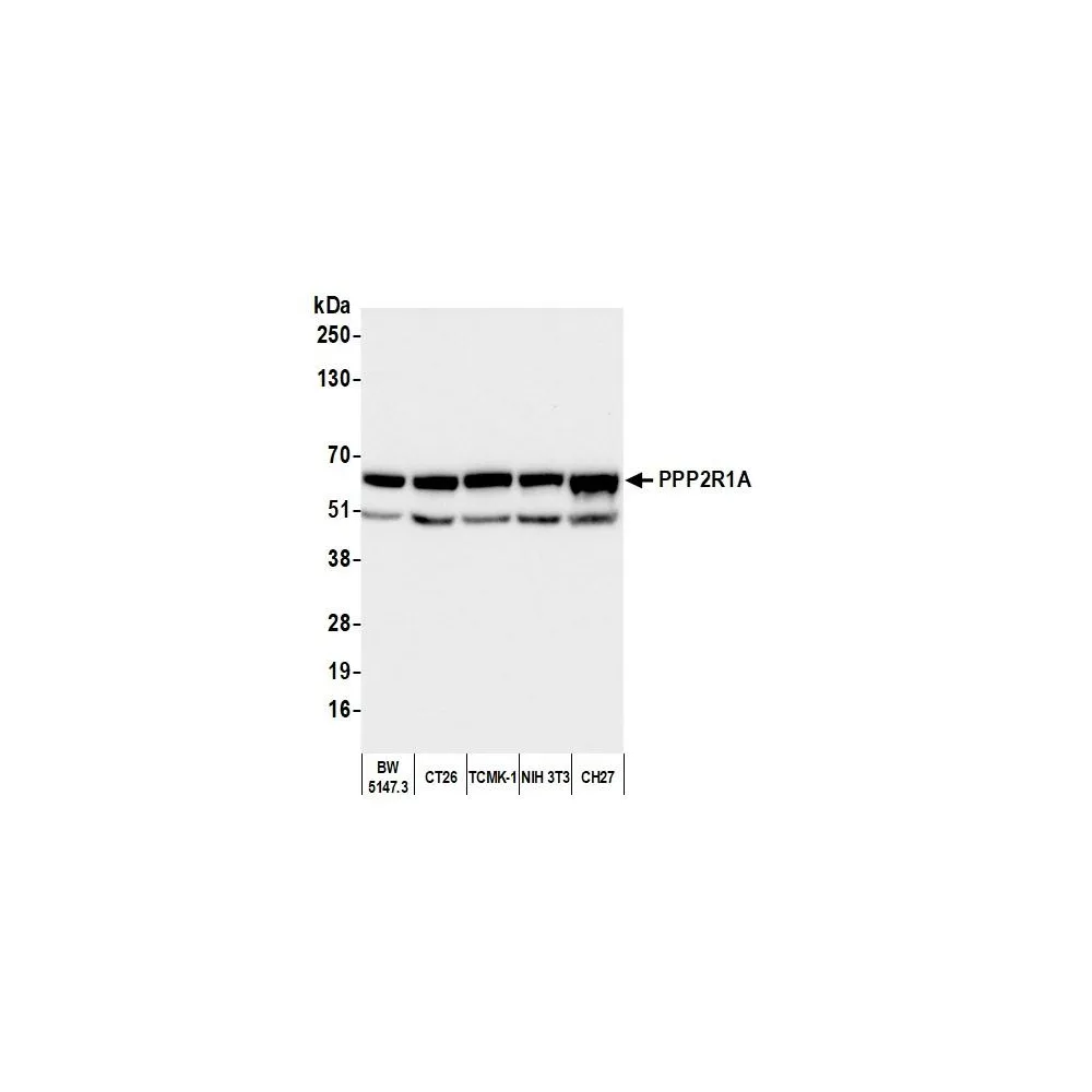 Rabbit anti-PPP2R1A Antibody, Affinity Purified