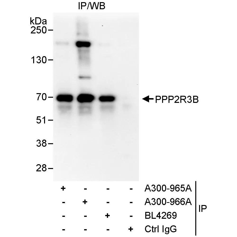 Rabbit anti-PPP2R3B Antibody, Affinity Purified