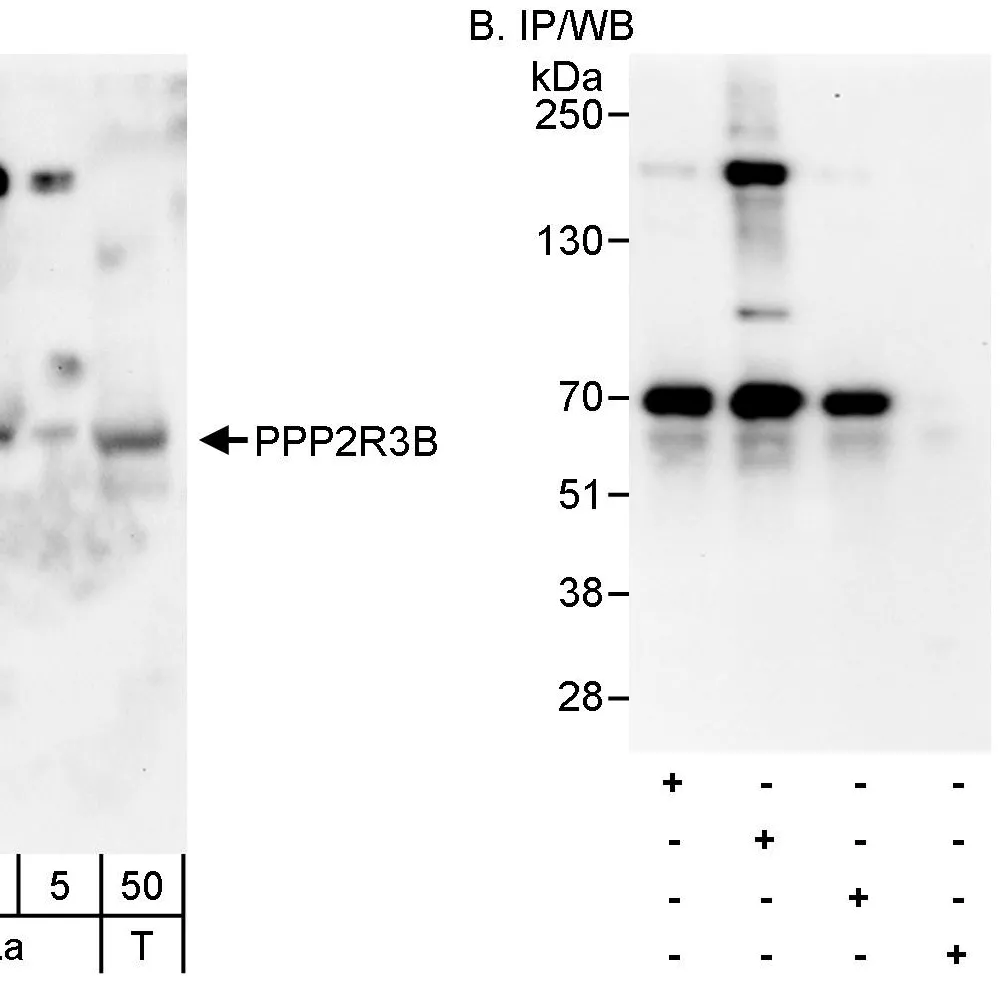 Rabbit anti-PPP2R3B Antibody, Affinity Purified