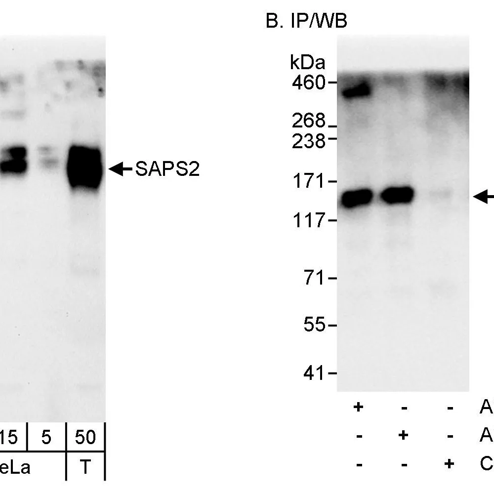 Rabbit anti-SAPS2 Antibody, Affinity Purified