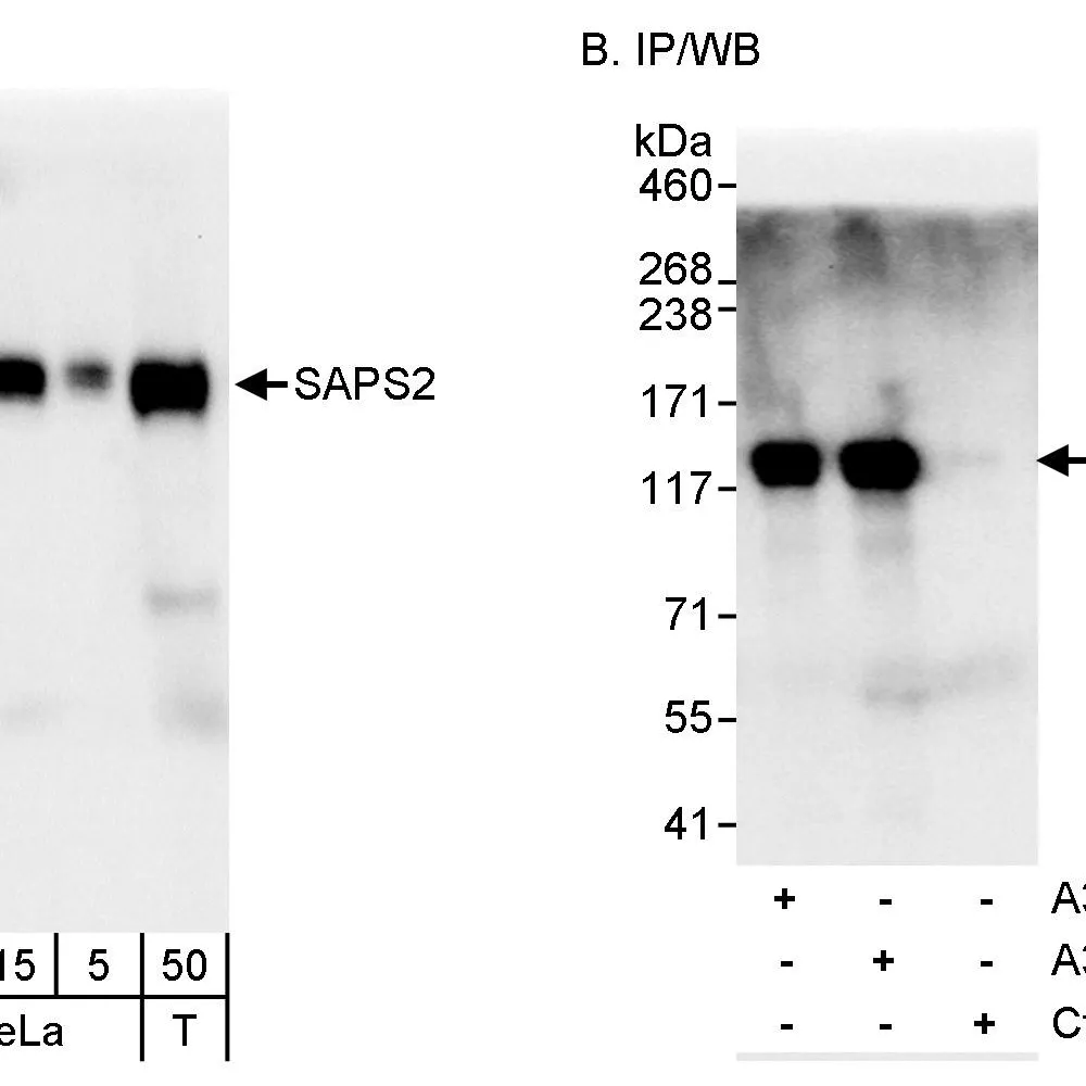 Rabbit anti-SAPS2 Antibody, Affinity Purified