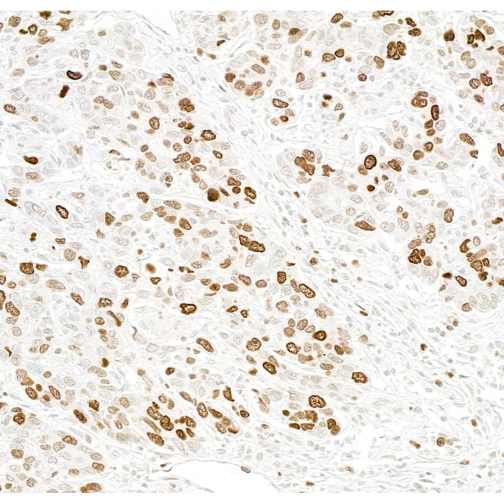 Rabbit anti-FALZ/BPTF Antibody, Affinity Purified