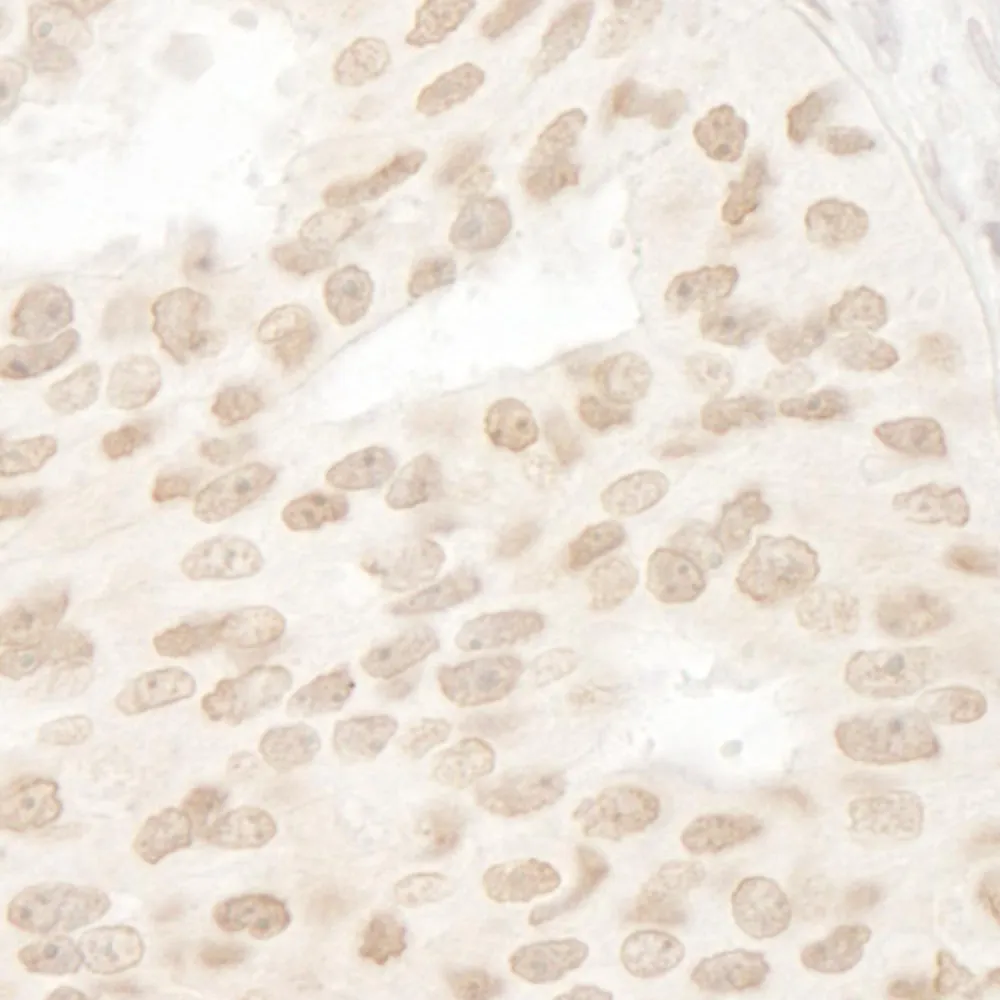 Rabbit anti-ANKRD28/PITK Antibody, Affinity Purified