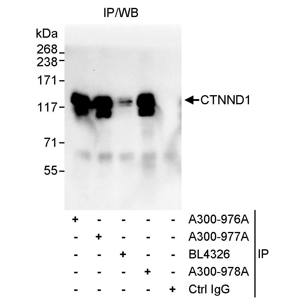 Rabbit anti-CTNND1 Antibody, Affinity Purified