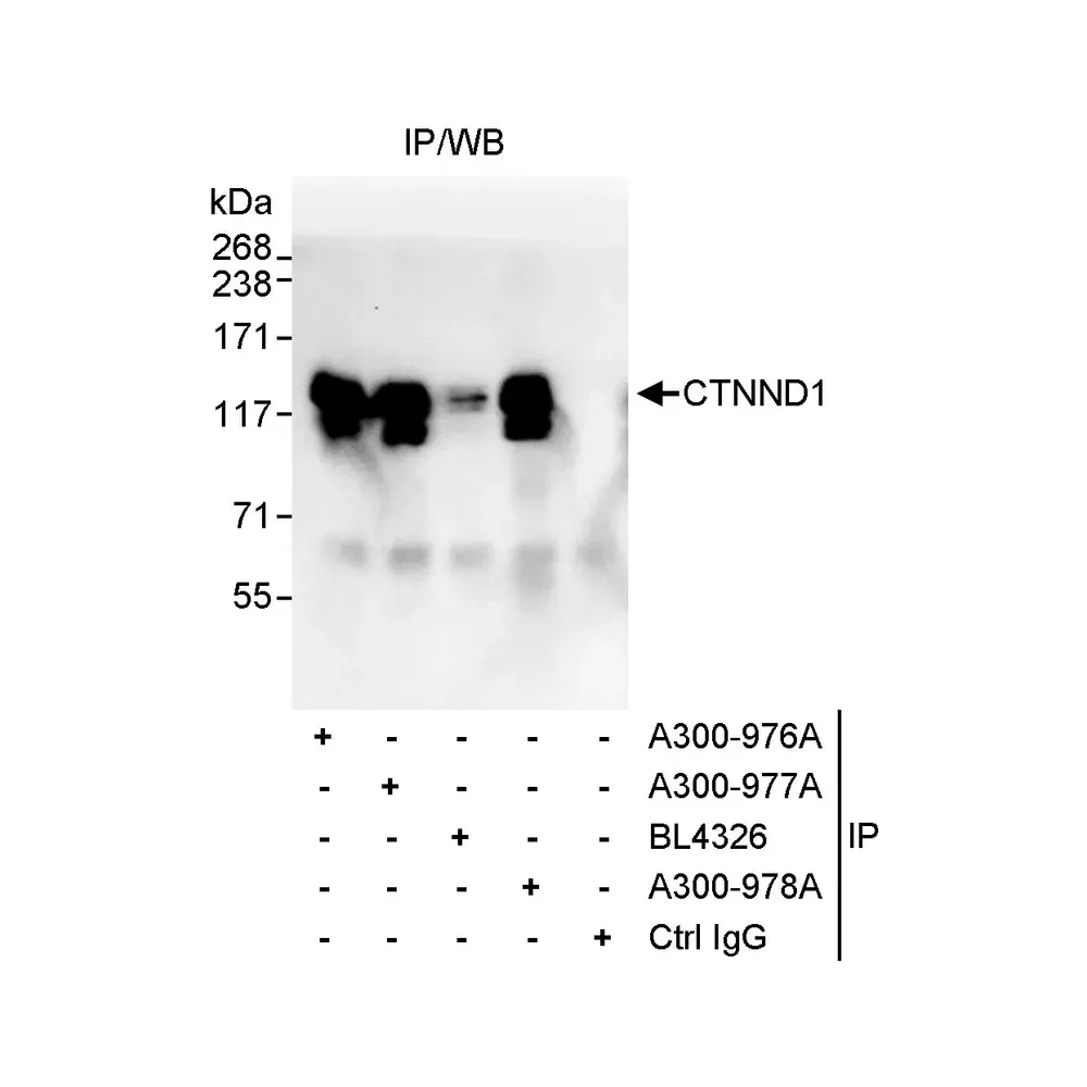 Rabbit anti-CTNND1 Antibody, Affinity Purified
