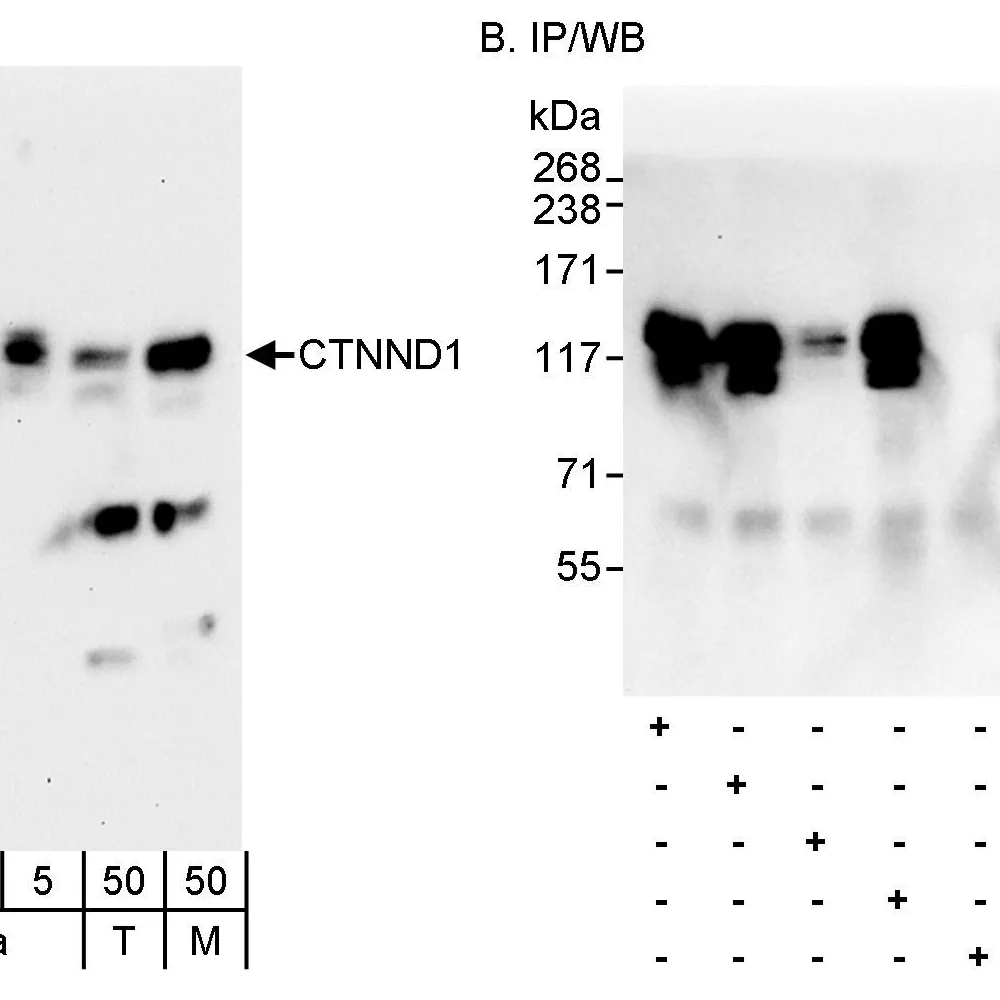 Rabbit anti-CTNND1 Antibody, Affinity Purified