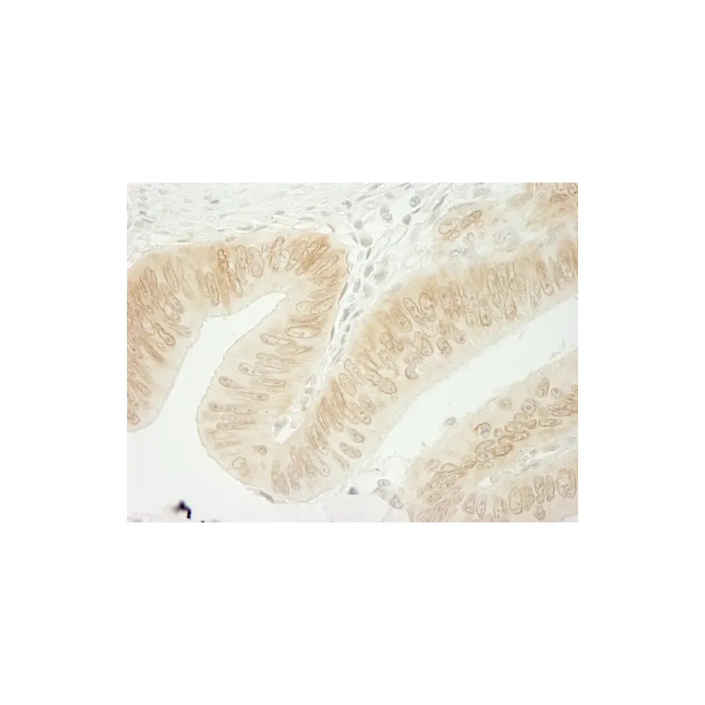 Rabbit anti-CTNND1 Antibody, Affinity Purified