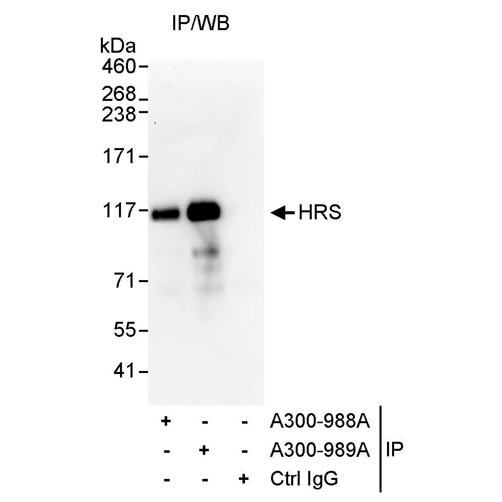 Rabbit anti-HRS Antibody, Affinity Purified