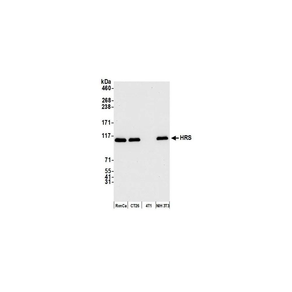 Rabbit anti-HRS Antibody, Affinity Purified