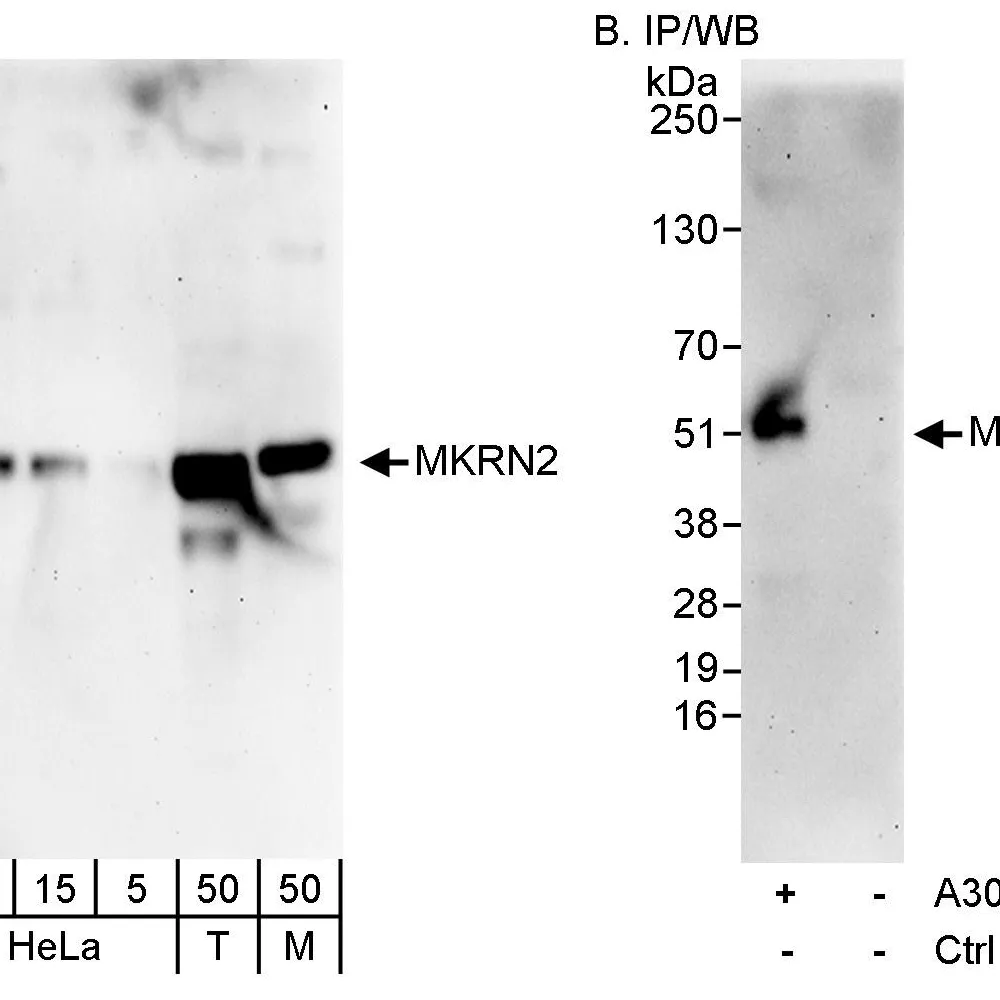 Rabbit anti-MKRN2 Antibody, Affinity Purified