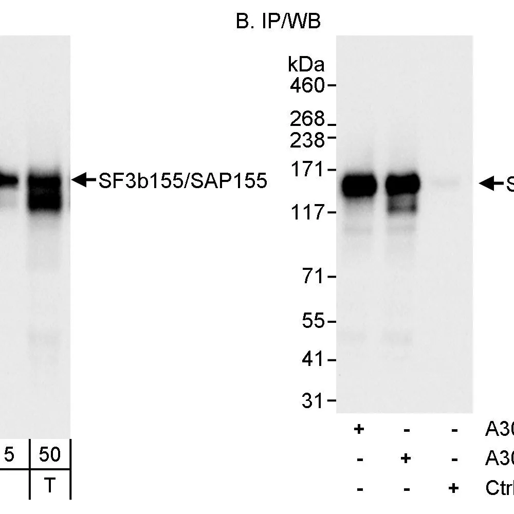 Rabbit anti-SF3b155/SAP155 Antibody, Affinity Purified