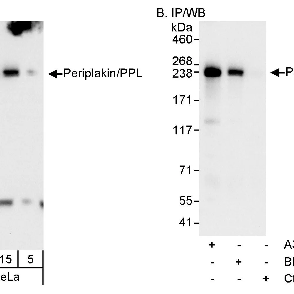 Rabbit anti-Periplakin/PPL Antibody, Affinity Purified
