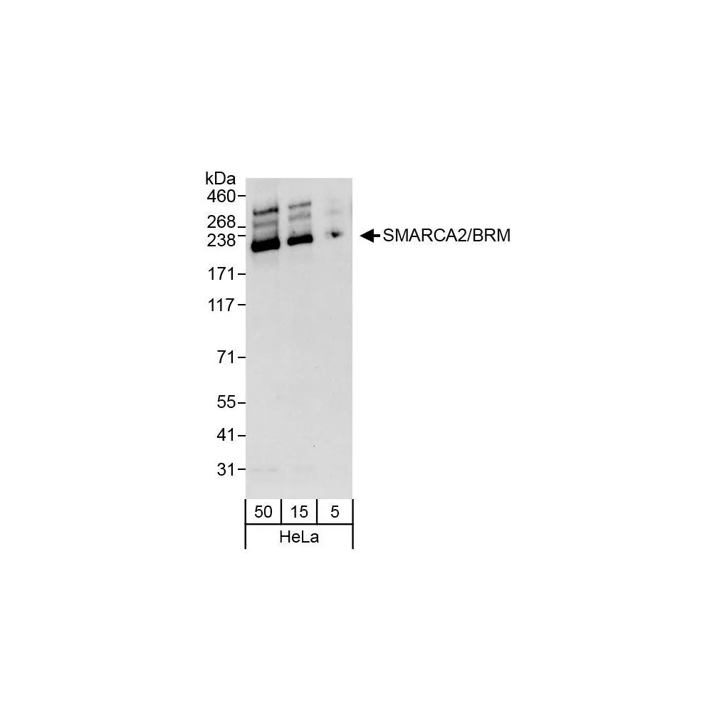 Rabbit anti-SMARCA2/BRM Antibody, Affinity Purified