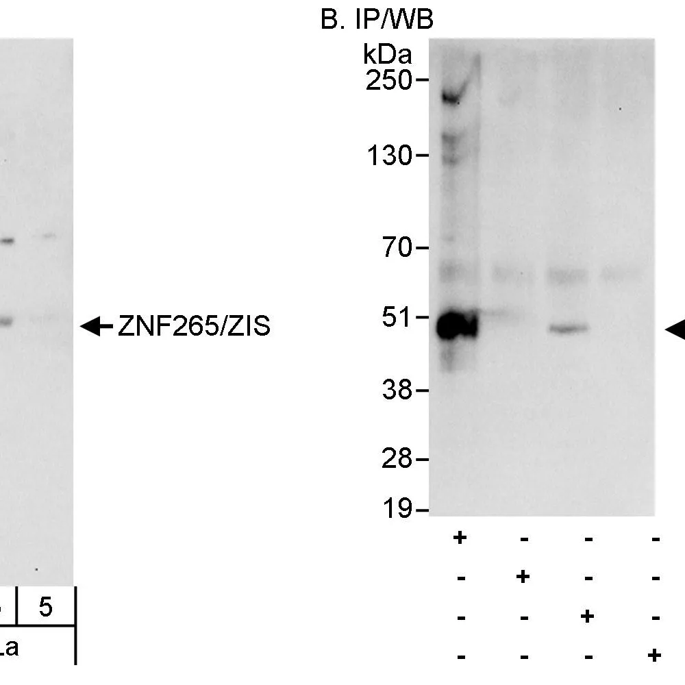 Rabbit anti-ZNF265/ZIS Antibody, Affinity Purified