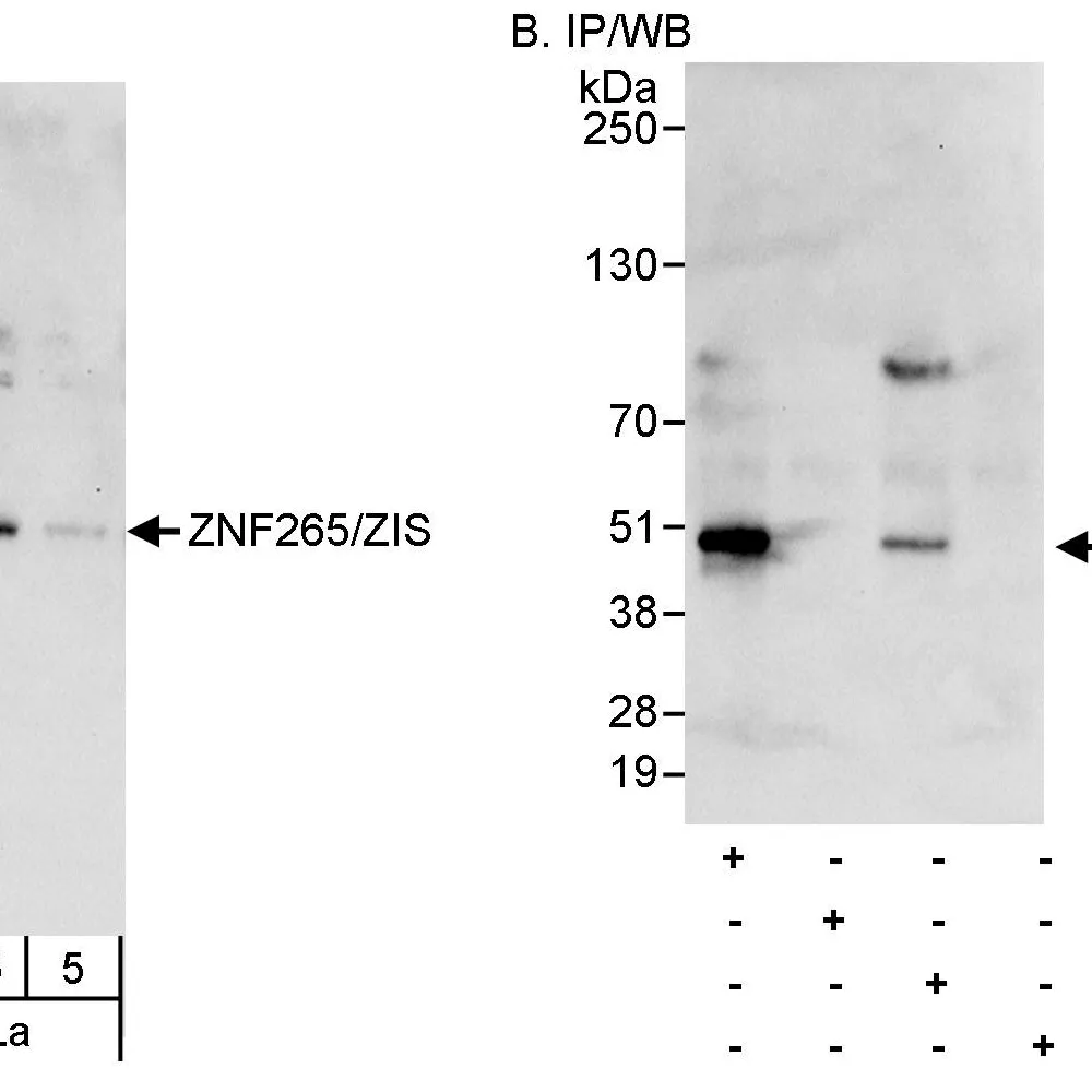 Rabbit anti-ZNF265/ZIS Antibody, Affinity Purified