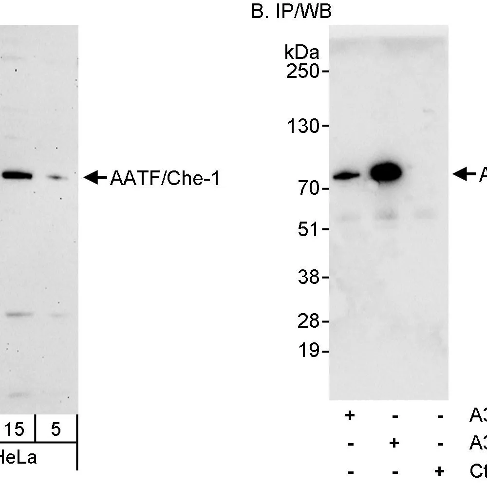 Rabbit anti-AATF/Che-1 Antibody, Affinity Purified