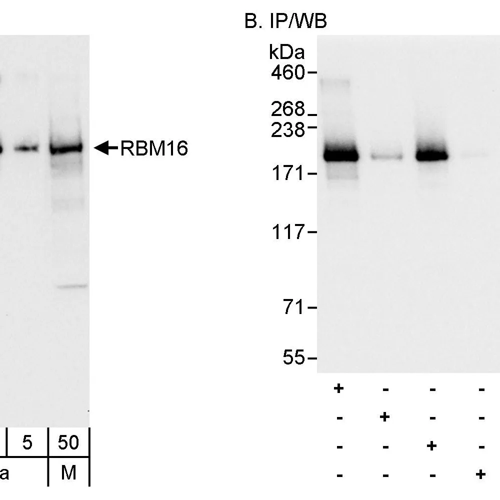 Rabbit anti-RBM16 Antibody, Affinity Purified