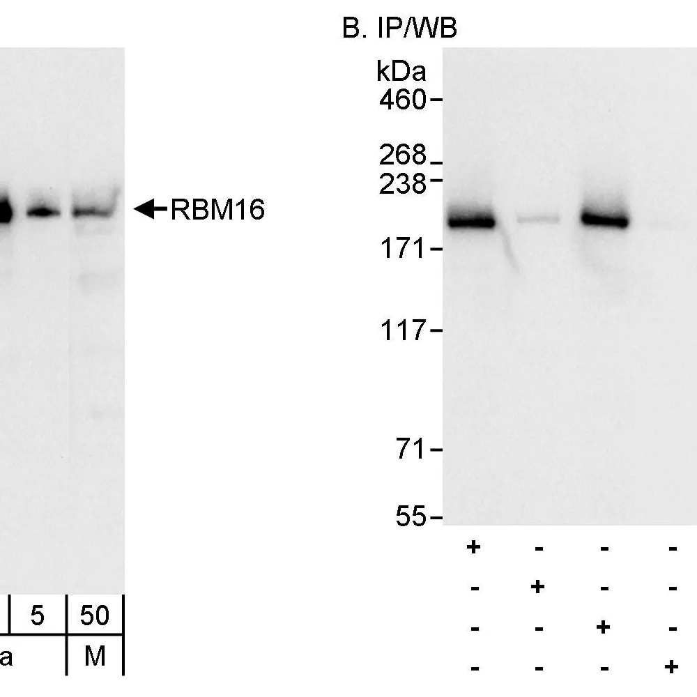 Rabbit anti-RBM16 Antibody, Affinity Purified