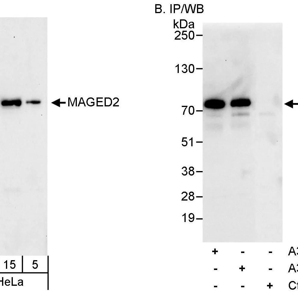 Rabbit anti-MAGED2 Antibody, Affinity Purified