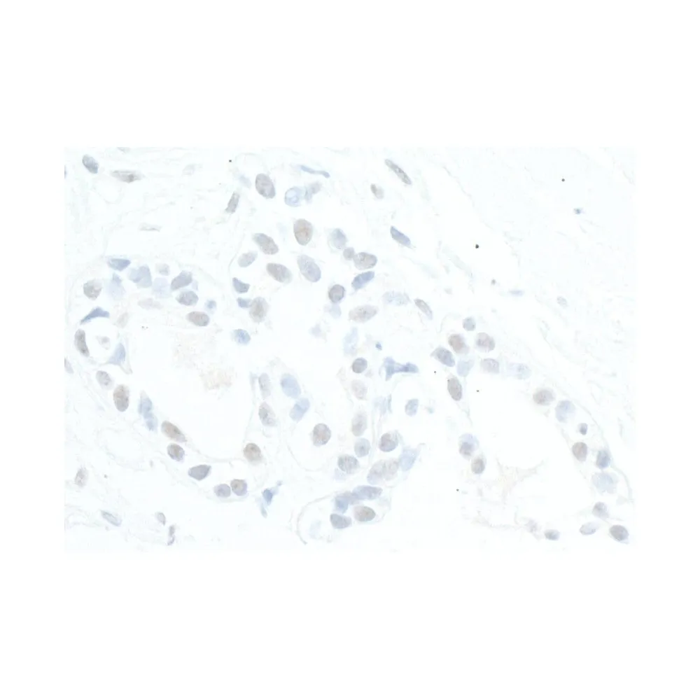 Rabbit anti-ATRX Antibody, Affinity Purified
