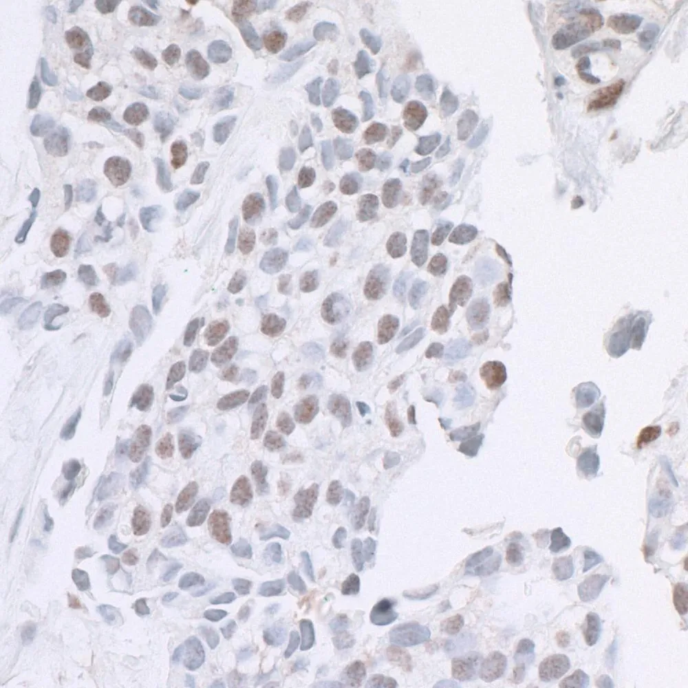 Rabbit anti-ARID1B Antibody, Affinity Purified