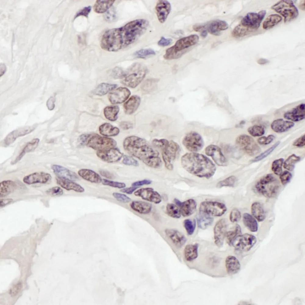 Rabbit anti-ARID1B Antibody, Affinity Purified