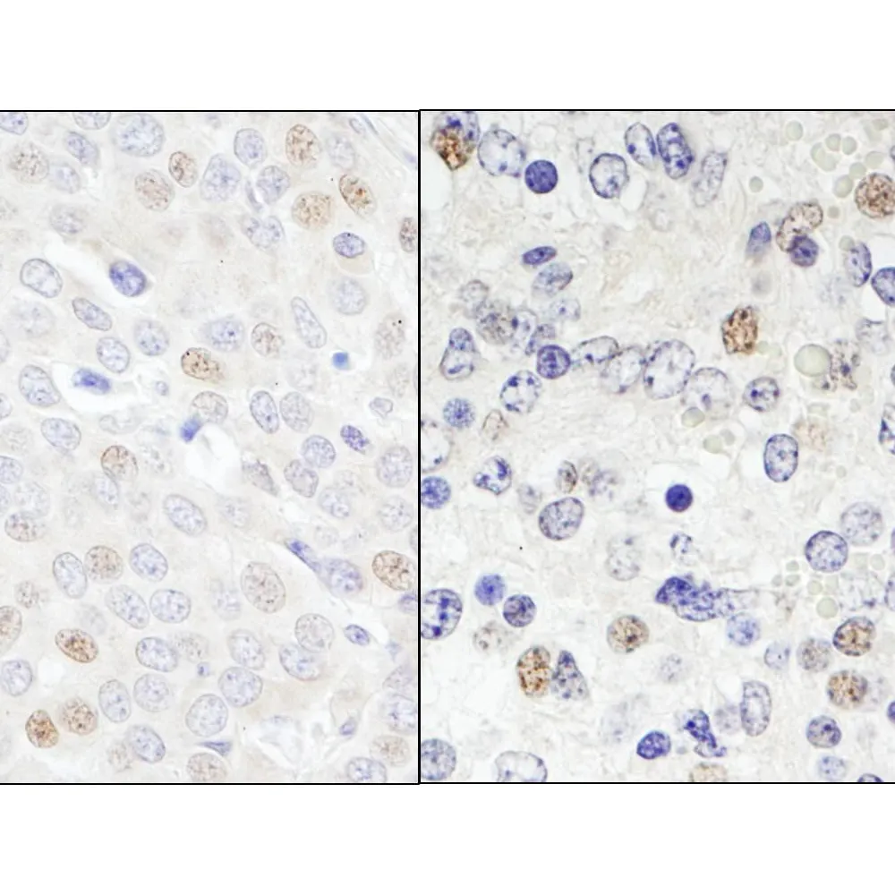Rabbit anti-DDX46 Antibody, Affinity Purified