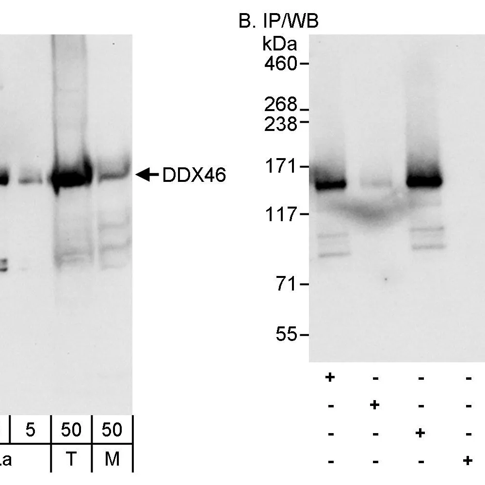 Rabbit anti-DDX46 Antibody, Affinity Purified