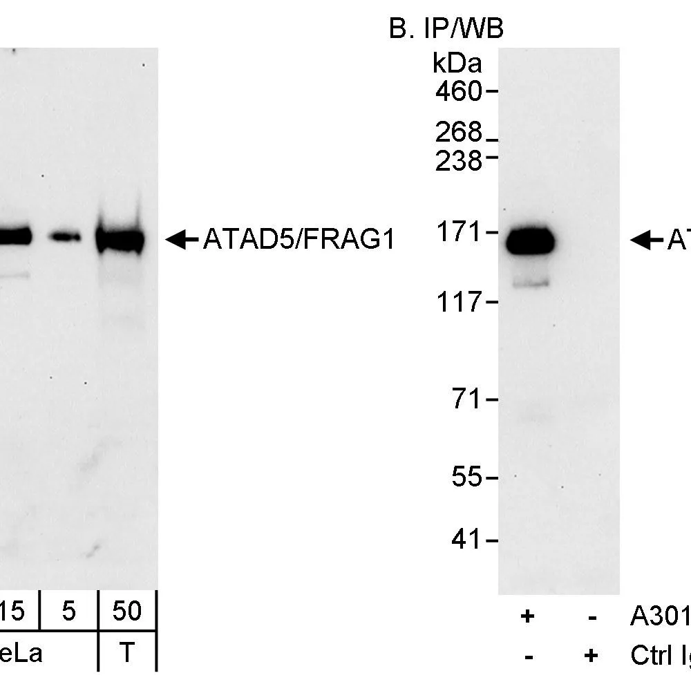Rabbit anti-ATAD5/FRAG1 Antibody, Affinity Purified