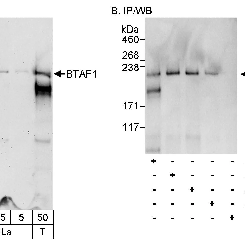 Rabbit anti-BTAF1 Antibody, Affinity Purified