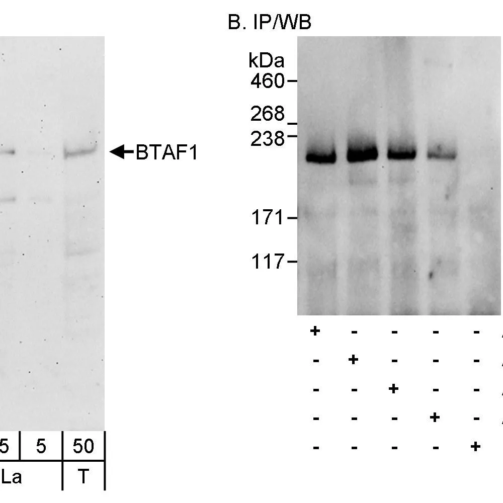 Rabbit anti-BTAF1 Antibody, Affinity Purified
