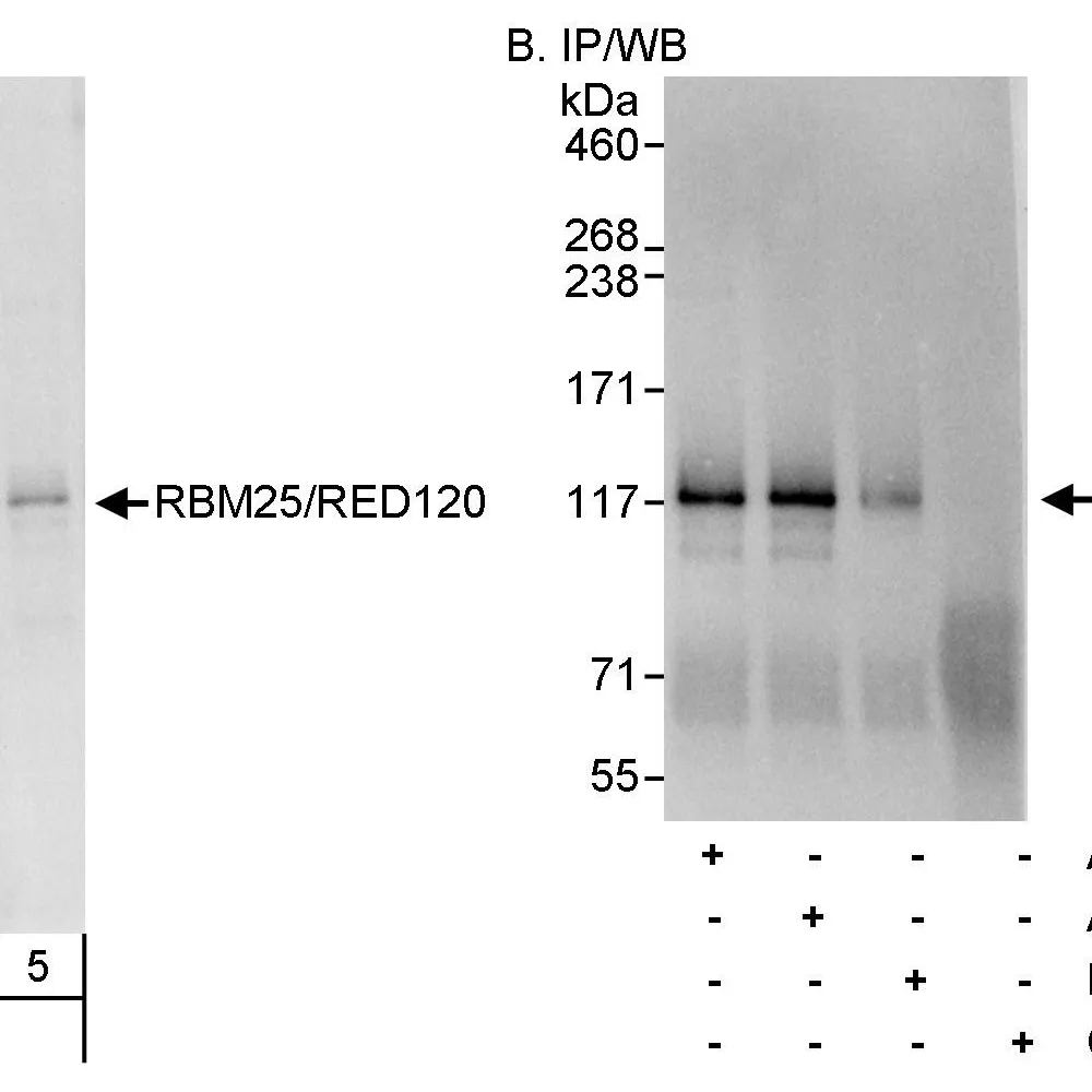 Rabbit anti-RBM25/RED120 Antibody, Affinity Purified