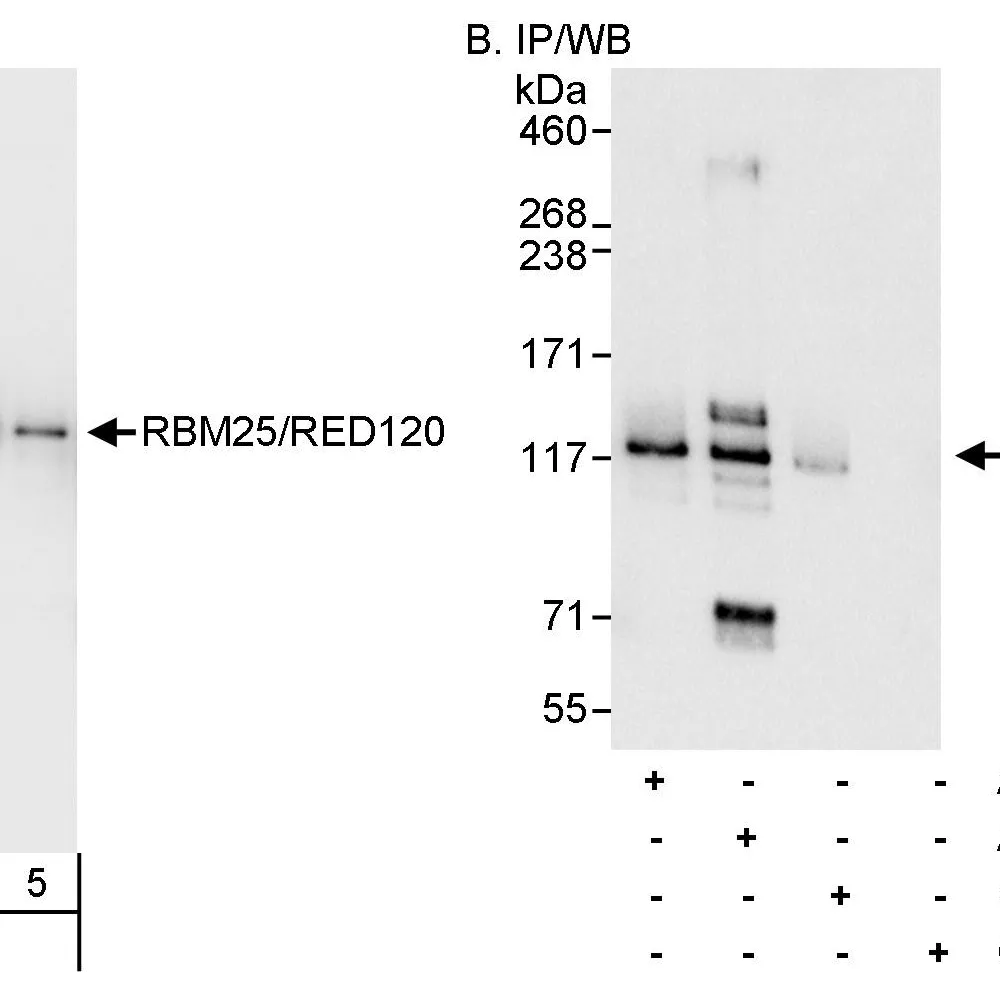 Rabbit anti-RBM25/RED120 Antibody, Affinity Purified