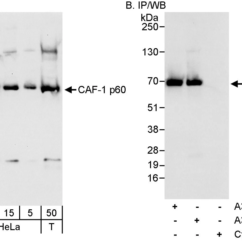 Rabbit anti-CAF-1 p60 Antibody, Affinity Purified