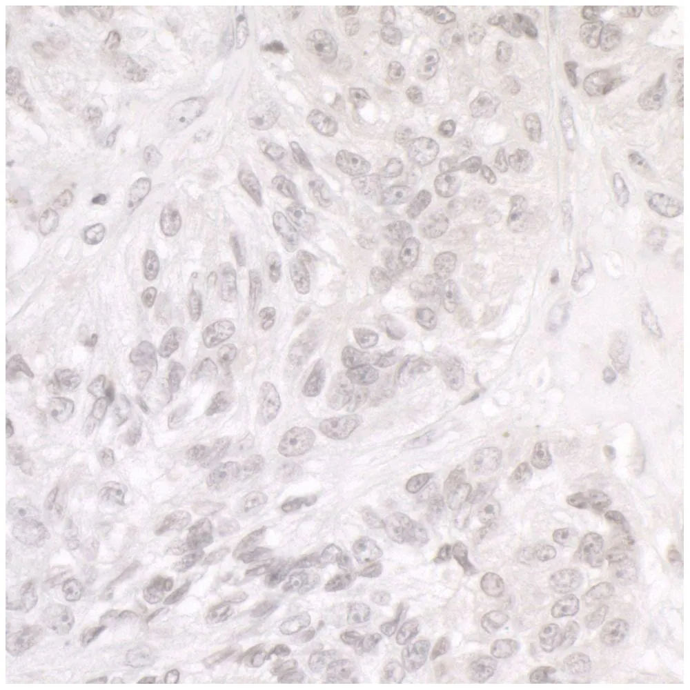 Rabbit anti-SMARCA1/SNF2L Antibody, Affinity Purified