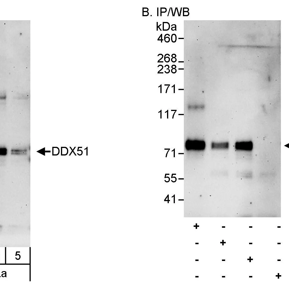 Rabbit anti-DDX51 Antibody, Affinity Purified