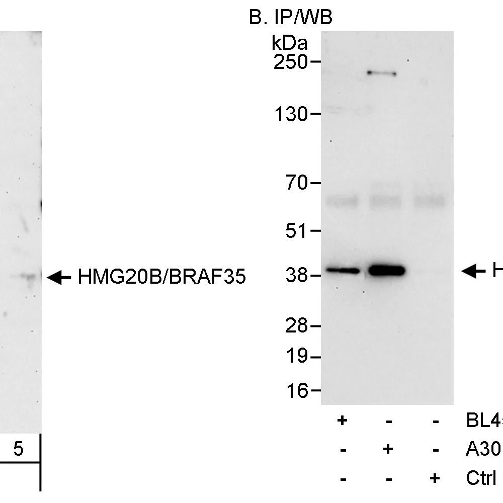 Rabbit anti-HMG20B/BRAF35 Antibody, Affinity Purified