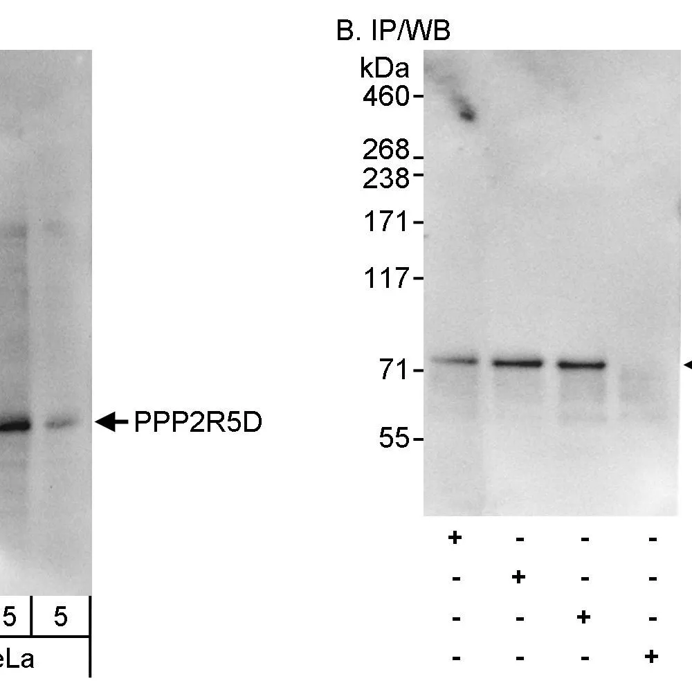 Rabbit anti-PPP2R5D Antibody, Affinity Purified