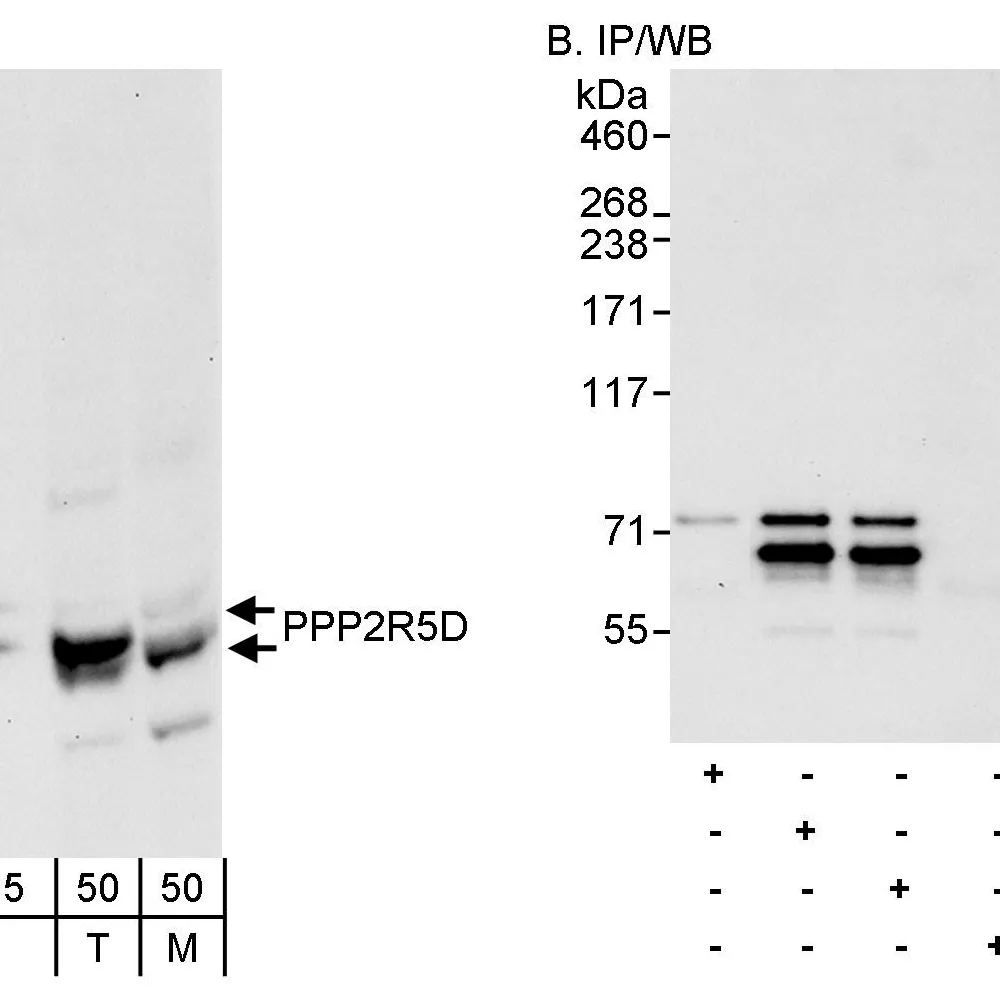 Rabbit anti-PPP2R5D Antibody, Affinity Purified