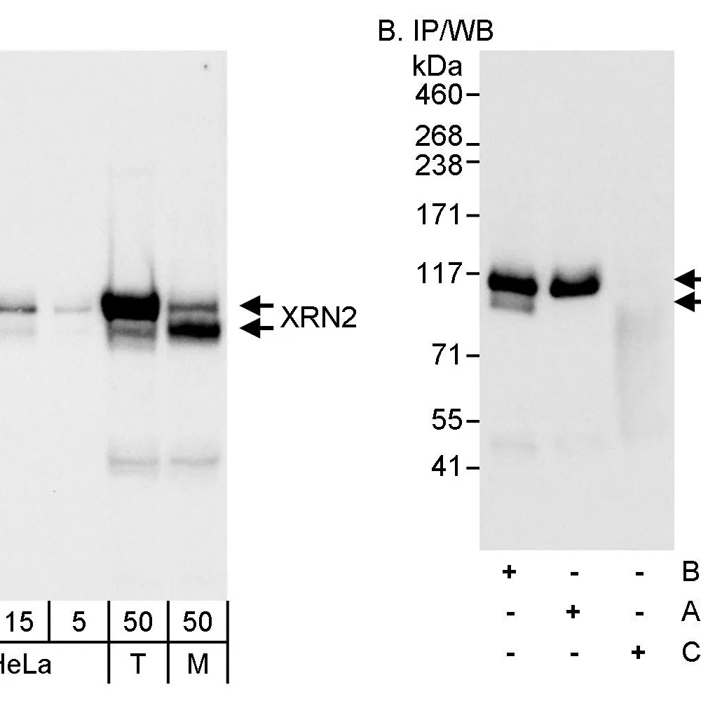 Rabbit anti-XRN2 Antibody, Affinity Purified