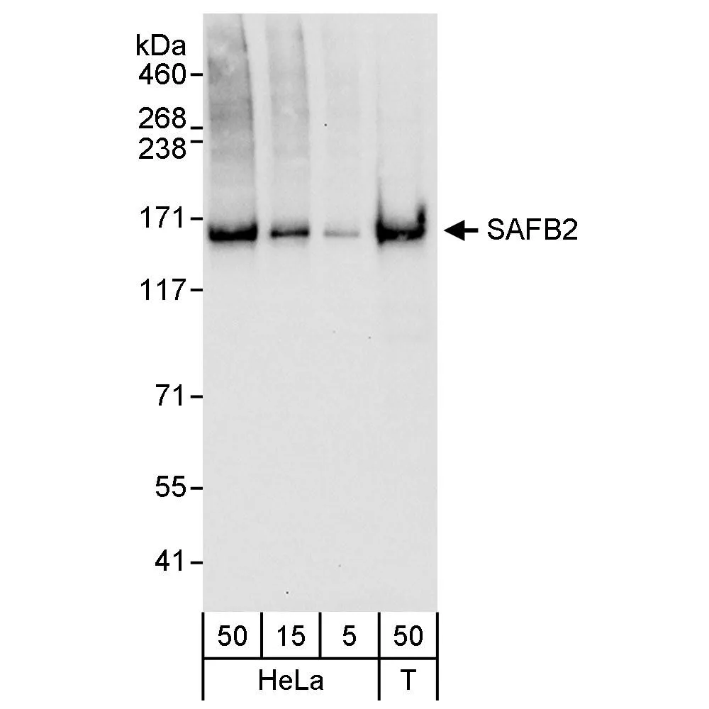 Rabbit anti-SAFB2 Antibody, Affinity Purified
